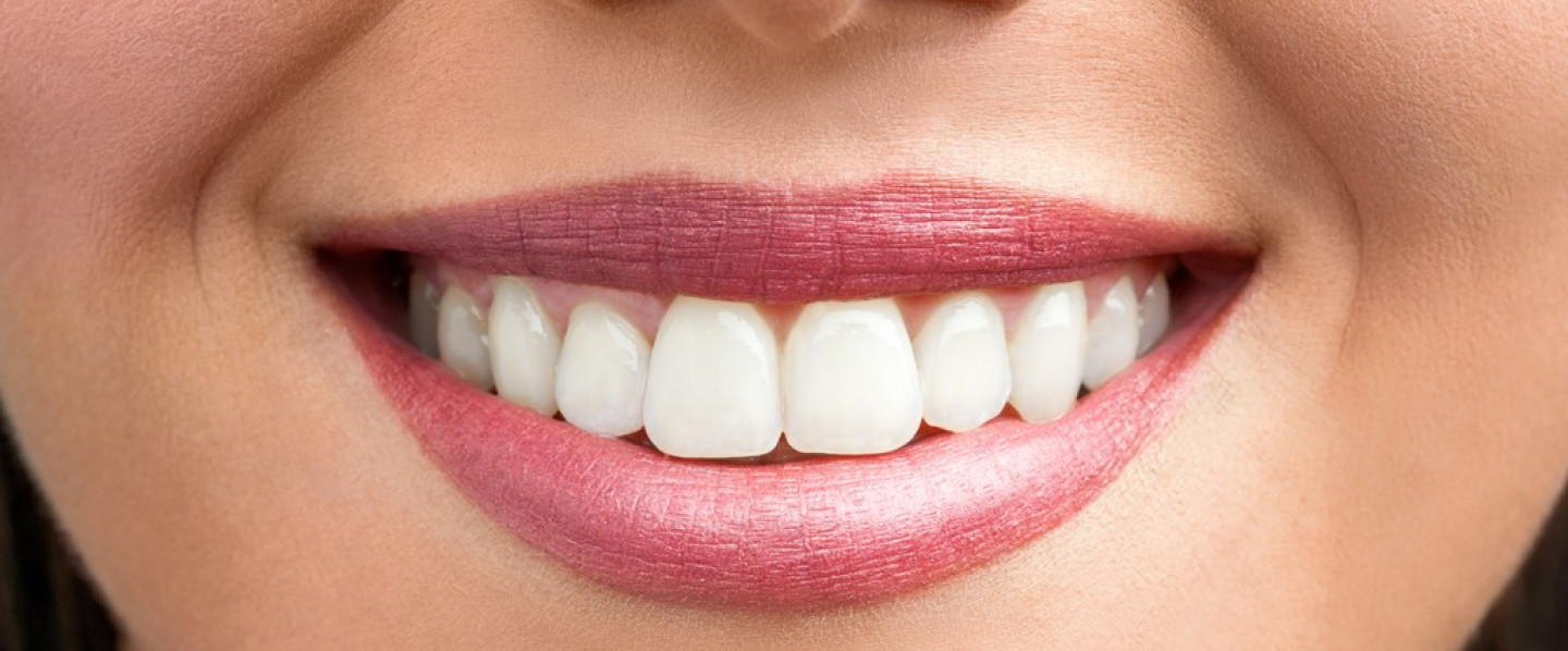 Whiten your Smile Easily